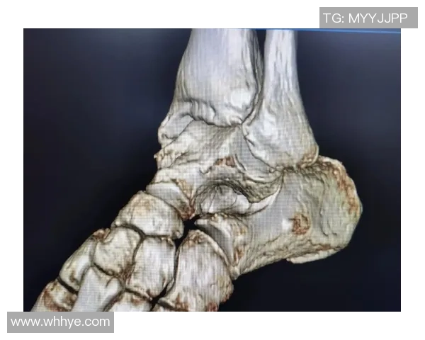 踢足球时脚踝疼痛的原因及缓解方法解析